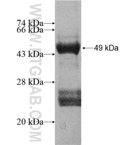 RPS5 fusion protein Ag10686 SDS-PAGE