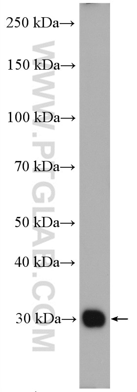 WB analysis of mouse kidney using 14823-1-AP