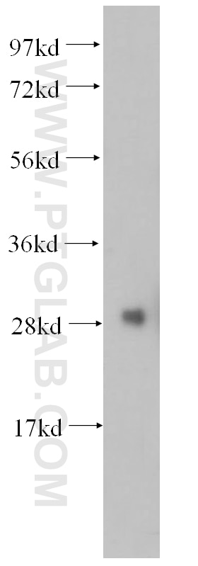 Western Blot (WB) analysis of K-562 cells using S6 Ribosomal protein Polyclonal antibody (14823-1-AP)