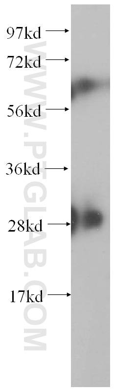 Western Blot (WB) analysis of MCF-7 cells using S6 ribosomal protein Polyclonal antibody (14823-1-AP)