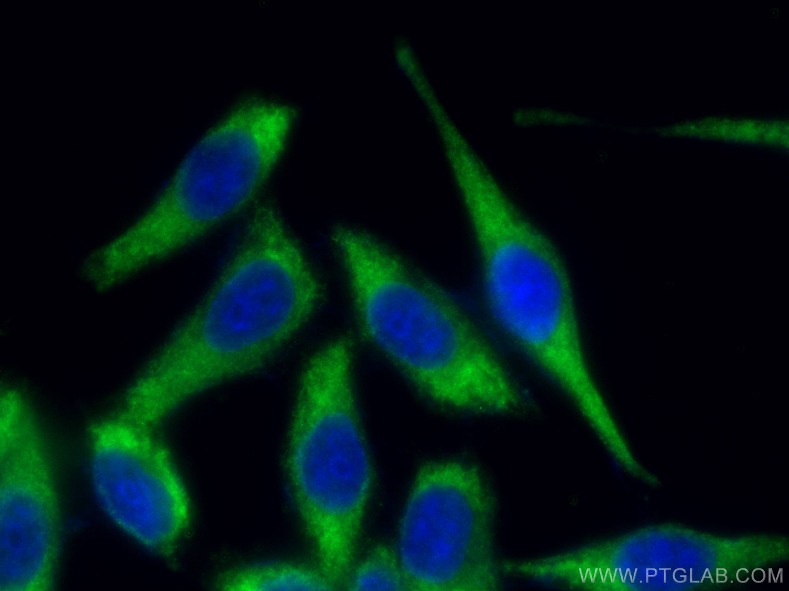 Immunofluorescence (IF) / fluorescent staining of HepG2 cells using S6 Ribosomal protein Recombinant antibody (80208-1-RR)