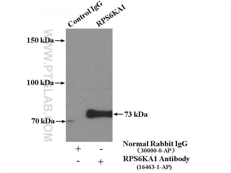 Immunoprecipitation (IP) experiment of K-562 cells using RPS6KA1 Polyclonal antibody (16463-1-AP)