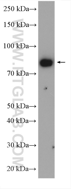Western Blot (WB) analysis of K-562 cells using RPS6KA1 Polyclonal antibody (16463-1-AP)