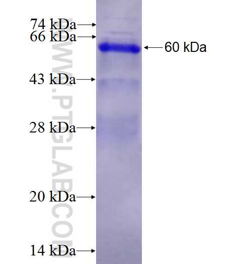 RPS6KA1 fusion protein Ag9537 SDS-PAGE