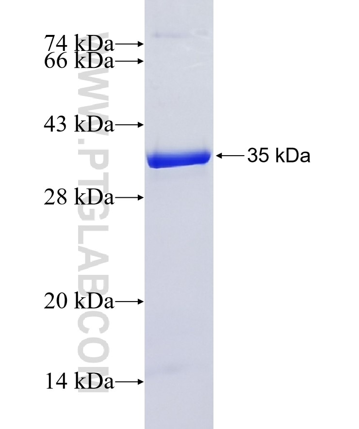 RPS6KA1 fusion protein Ag9655 SDS-PAGE