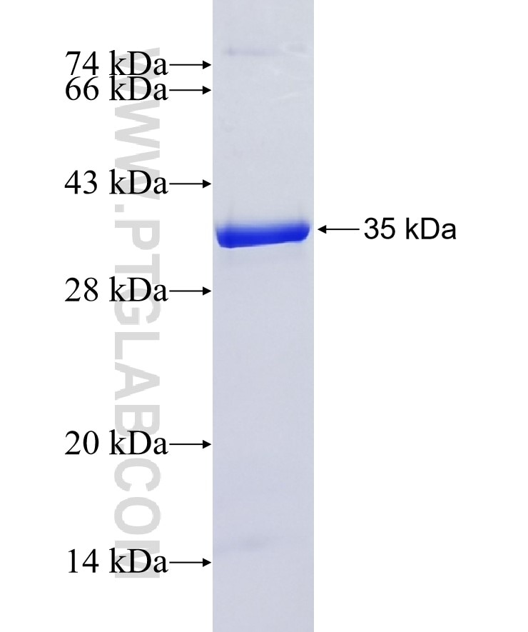 RPS6KA1 fusion protein Ag9655 SDS-PAGE