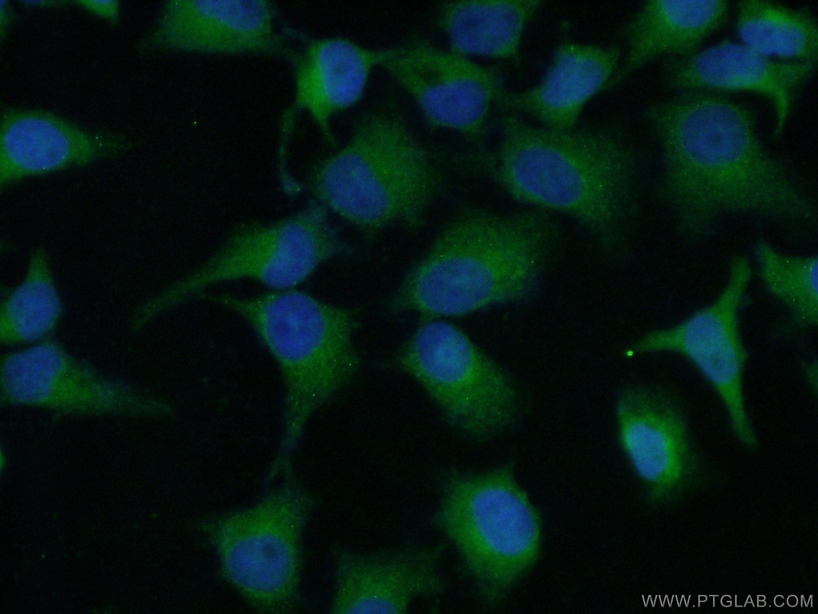 Immunofluorescence (IF) / fluorescent staining of HeLa cells using RSK3 Polyclonal antibody (14446-1-AP)