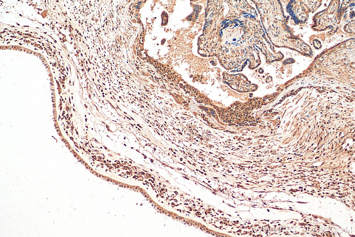 Immunohistochemistry (IHC) staining of human placenta tissue using RSK3 Polyclonal antibody (14446-1-AP)