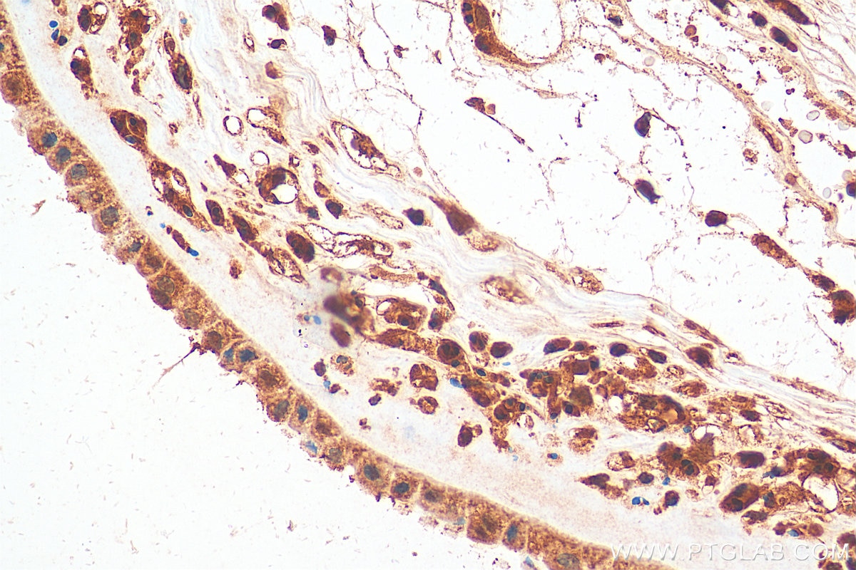 Immunohistochemistry (IHC) staining of human placenta tissue using RSK3 Polyclonal antibody (14446-1-AP)