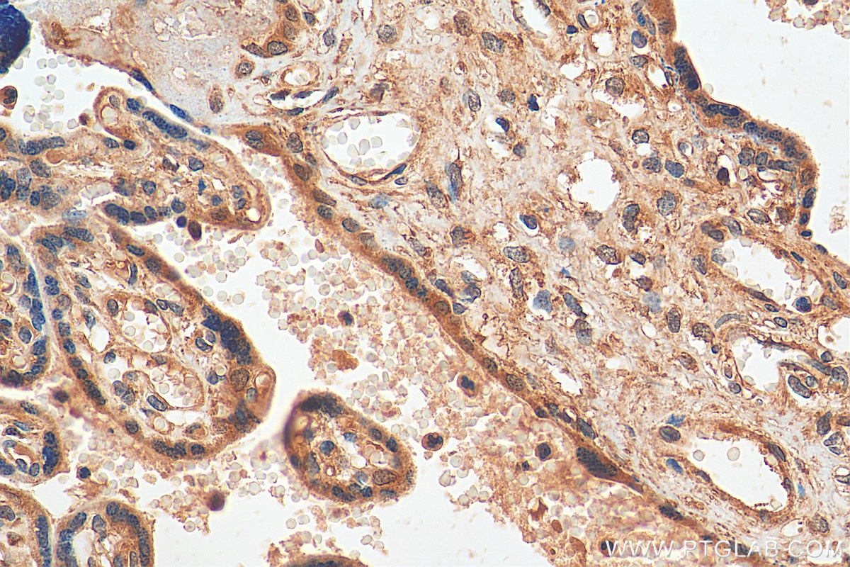 IHC staining of human placenta using 14446-1-AP