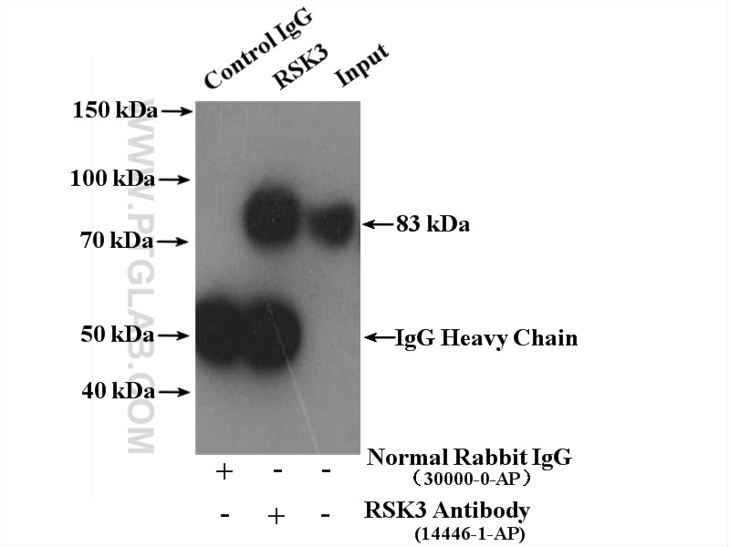 Immunoprecipitation (IP) experiment of HeLa cells using RSK3 Polyclonal antibody (14446-1-AP)