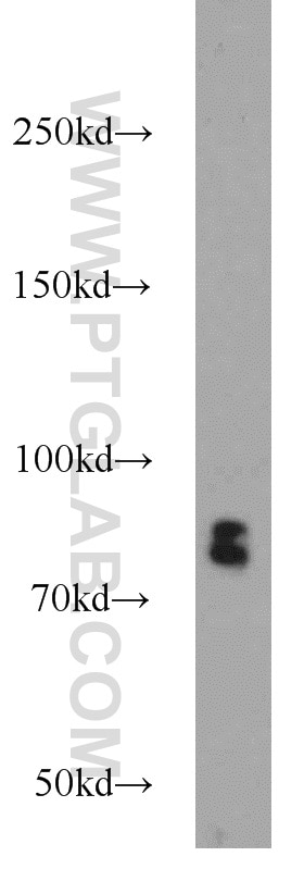 Western Blot (WB) analysis of HeLa cells using RSK3 Polyclonal antibody (14446-1-AP)