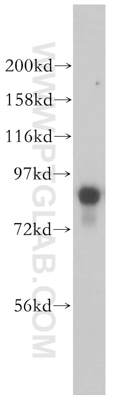 Western Blot (WB) analysis of NIH/3T3 cells using RSK3 Polyclonal antibody (14446-1-AP)