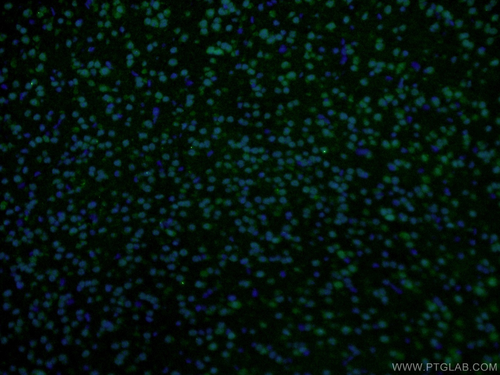 Immunofluorescence (IF) / fluorescent staining of mouse brain tissue using RSK2 Polyclonal antibody (23762-1-AP)