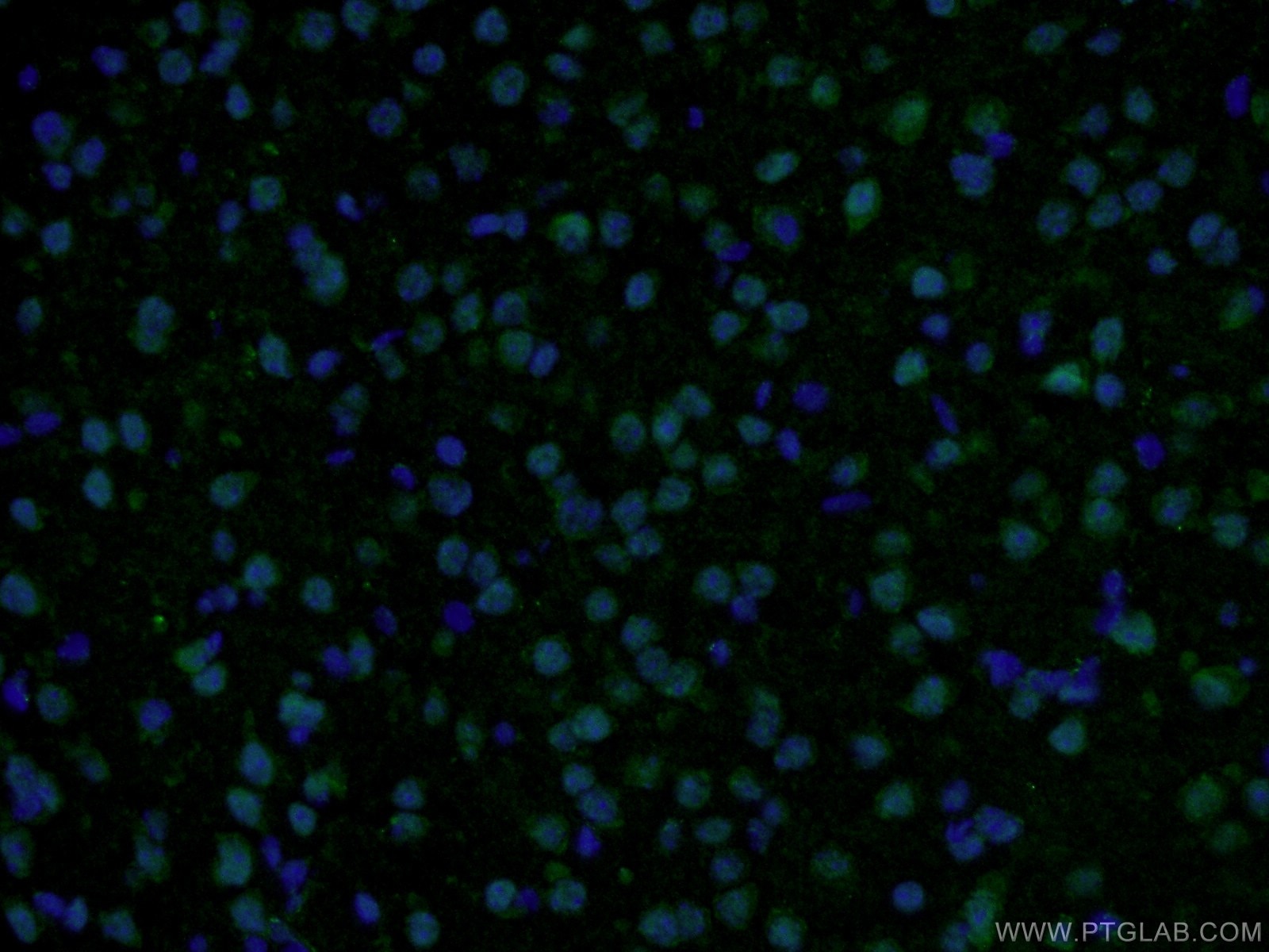 Immunofluorescence (IF) / fluorescent staining of mouse brain tissue using RSK2 Polyclonal antibody (23762-1-AP)