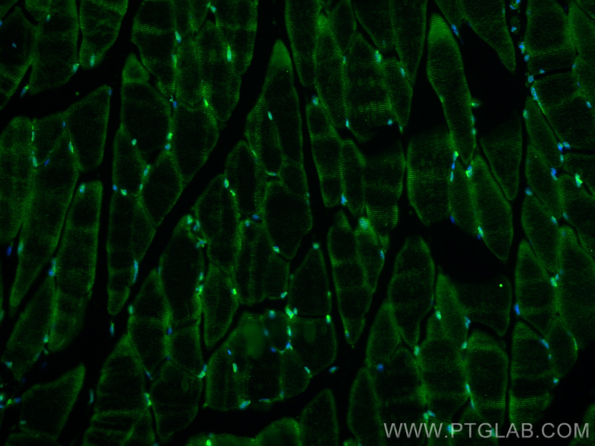 Immunofluorescence (IF) / fluorescent staining of mouse skeletal muscle tissue using RSK2 Polyclonal antibody (23762-1-AP)
