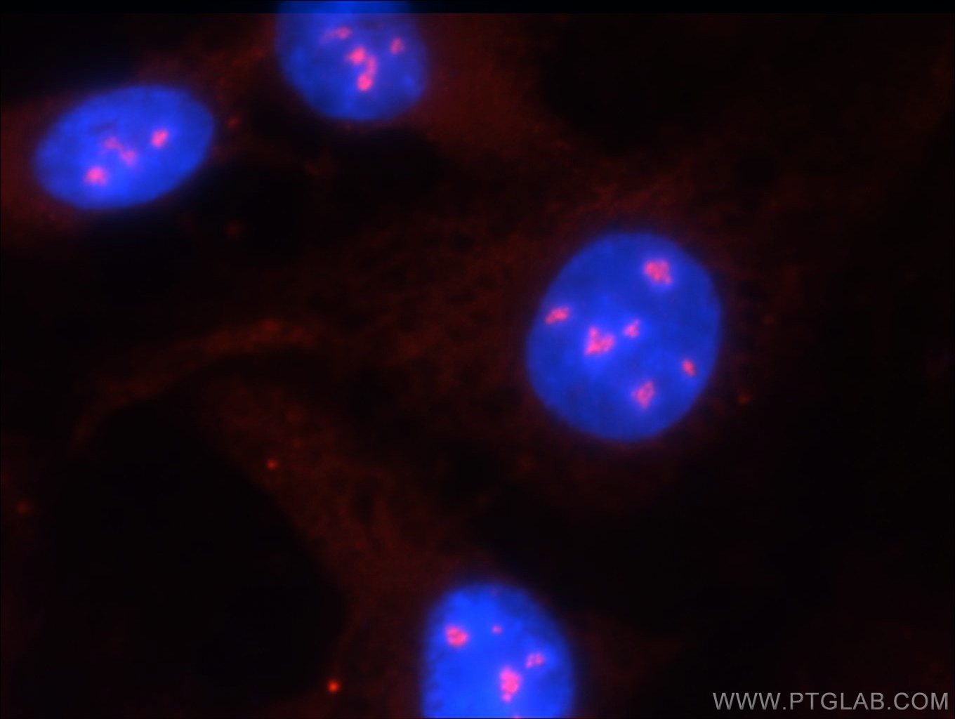 Immunofluorescence (IF) / fluorescent staining of HUVEC cells using RSK2 Polyclonal antibody (23762-1-AP)