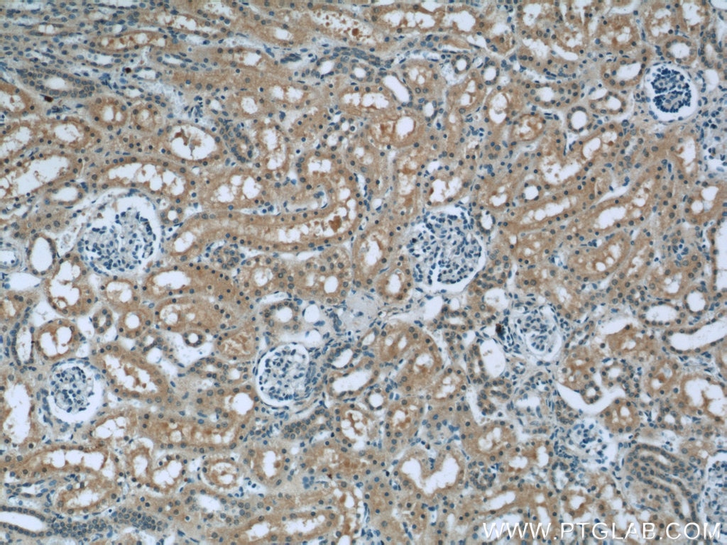 Immunohistochemistry (IHC) staining of human kidney tissue using RSK2 Polyclonal antibody (23762-1-AP)