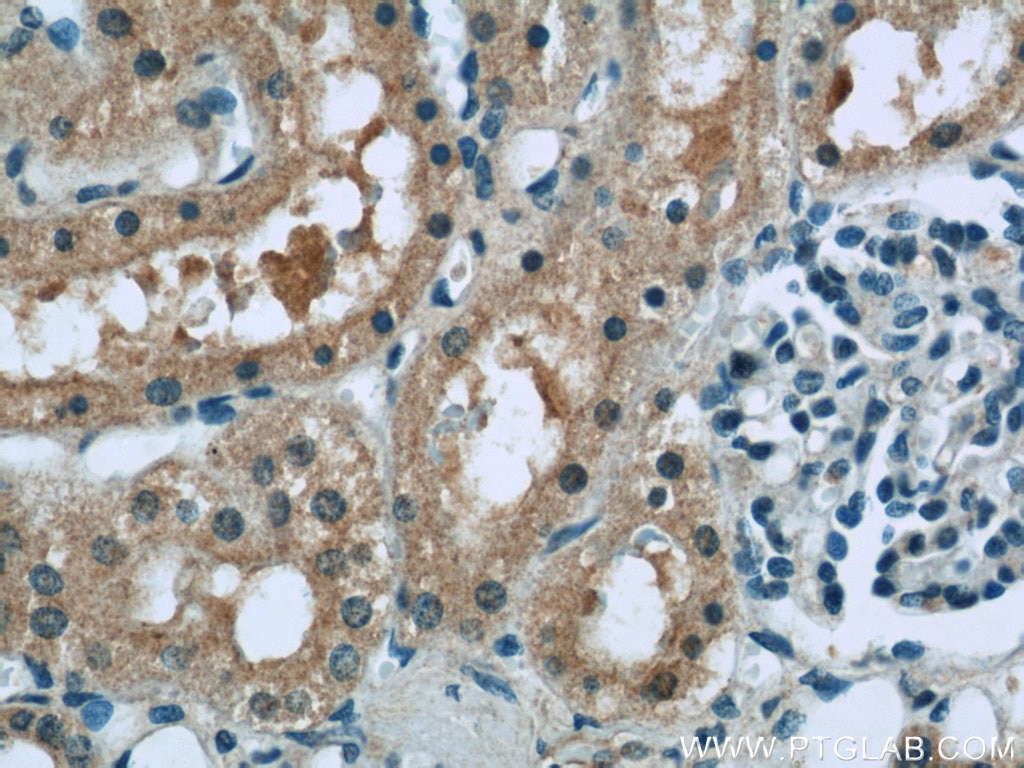 Immunohistochemistry (IHC) staining of human kidney tissue using RSK2 Polyclonal antibody (23762-1-AP)