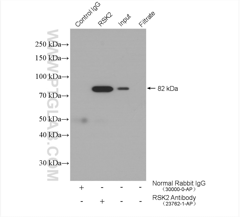 IP experiment of K-562 using 23762-1-AP