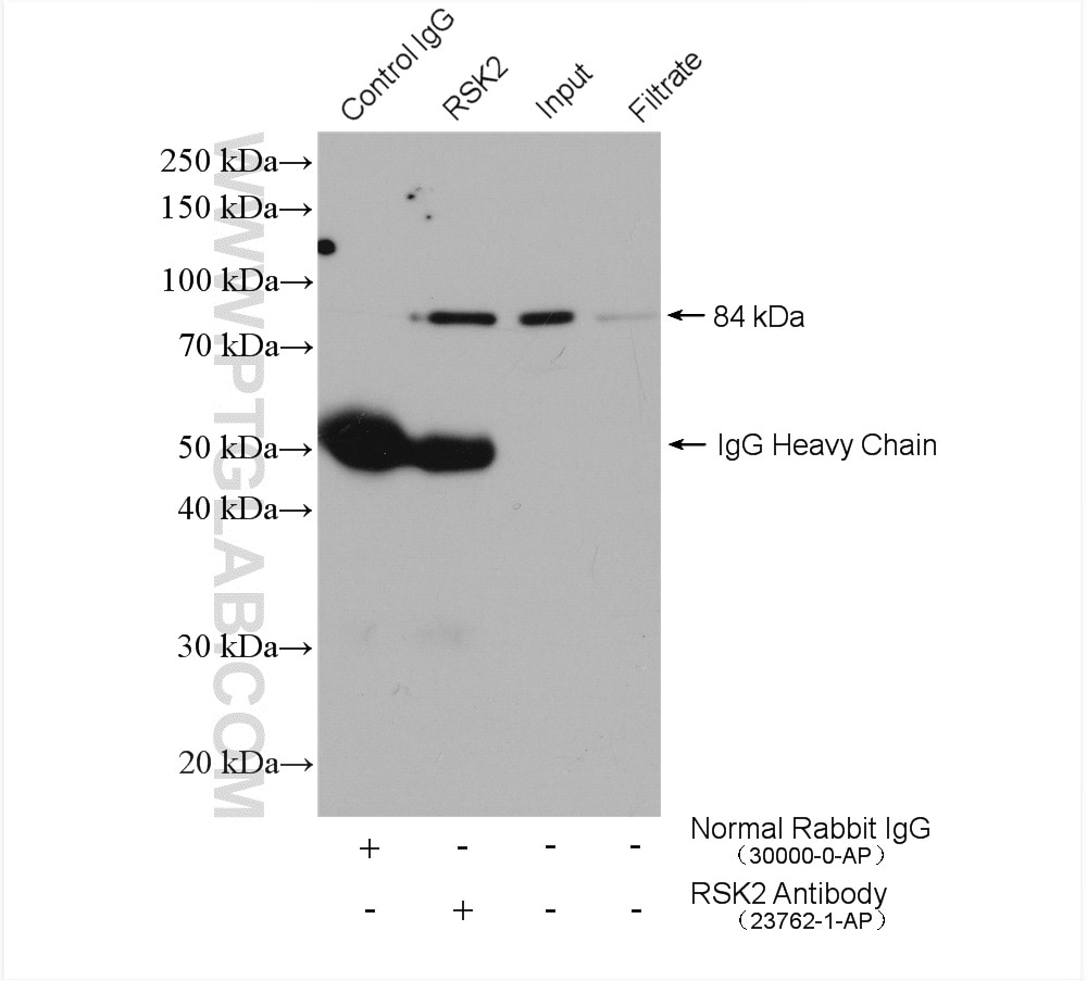 Immunoprecipitation (IP) experiment of K-562 cells using RSK2 Polyclonal antibody (23762-1-AP)