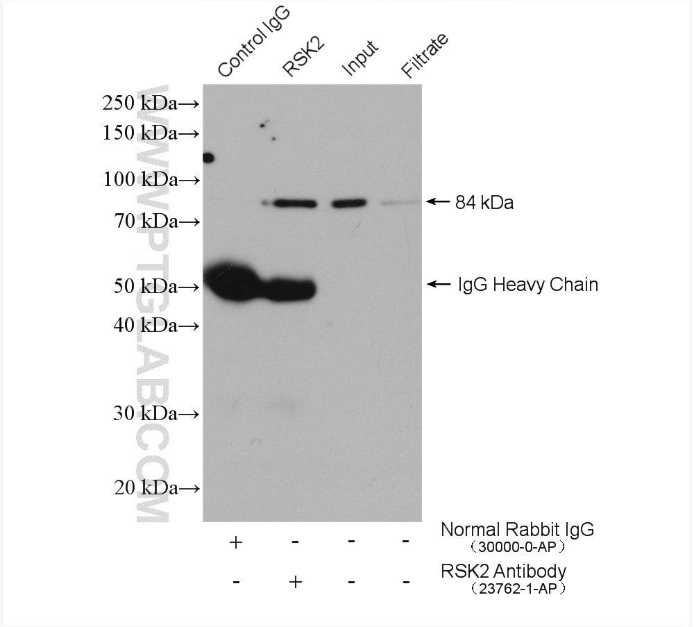 IP experiment of K-562 using 23762-1-AP