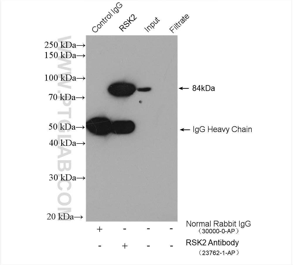 Immunoprecipitation (IP) experiment of K-562 cells using RSK2 Polyclonal antibody (23762-1-AP)