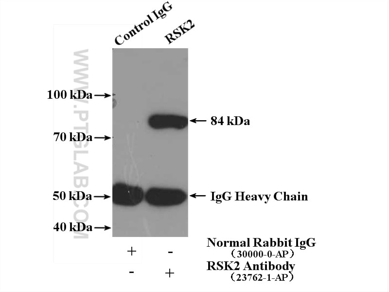 IP experiment of K-562 using 23762-1-AP