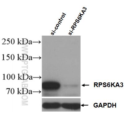 Western Blot (WB) analysis of K-562 cells using RSK2 Polyclonal antibody (23762-1-AP)