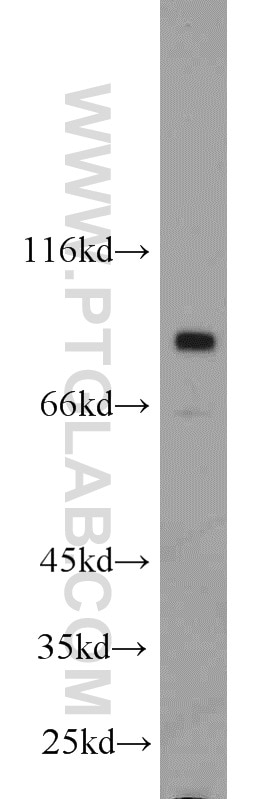 Western Blot (WB) analysis of MCF-7 cells using RSK2 Polyclonal antibody (23762-1-AP)