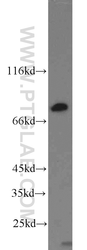 Western Blot (WB) analysis of NIH/3T3 cells using RSK2 Polyclonal antibody (23762-1-AP)