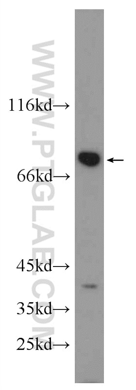 Western Blot (WB) analysis of HepG2 cells using RSK2 Polyclonal antibody (23762-1-AP)