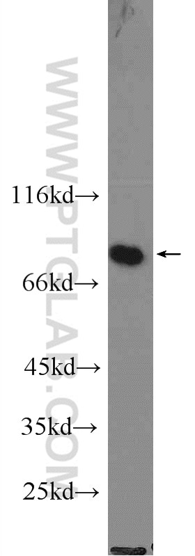 RSK2 Polyclonal antibody