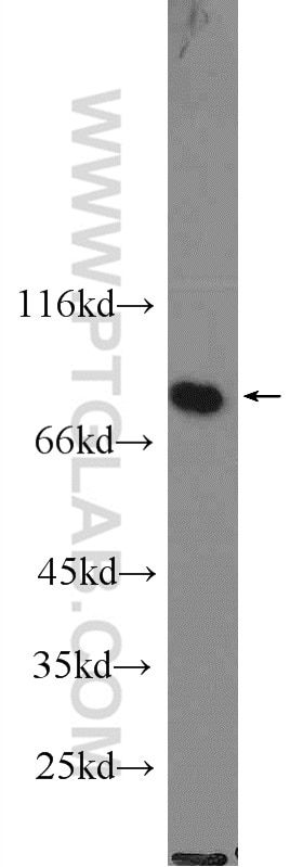 Western Blot (WB) analysis of K-562 cells using RSK2 Polyclonal antibody (23762-1-AP)