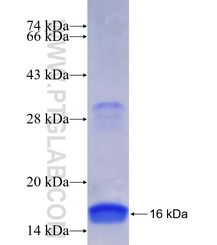 RPS6KA3 fusion protein Ag30451 SDS-PAGE
