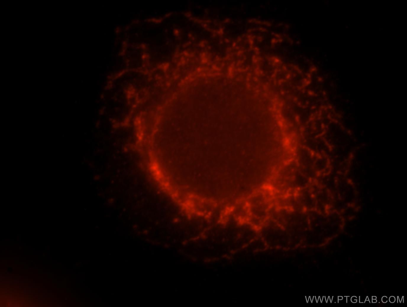Immunofluorescence (IF) / fluorescent staining of MCF-7 cells using MSK1 Polyclonal antibody (15977-1-AP)