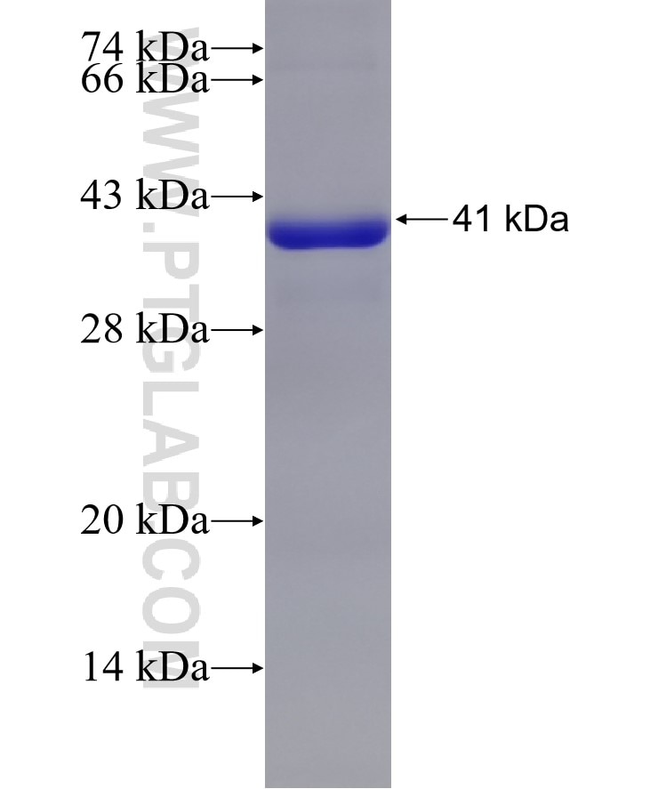 RPS6KA5 fusion protein Ag8837 SDS-PAGE