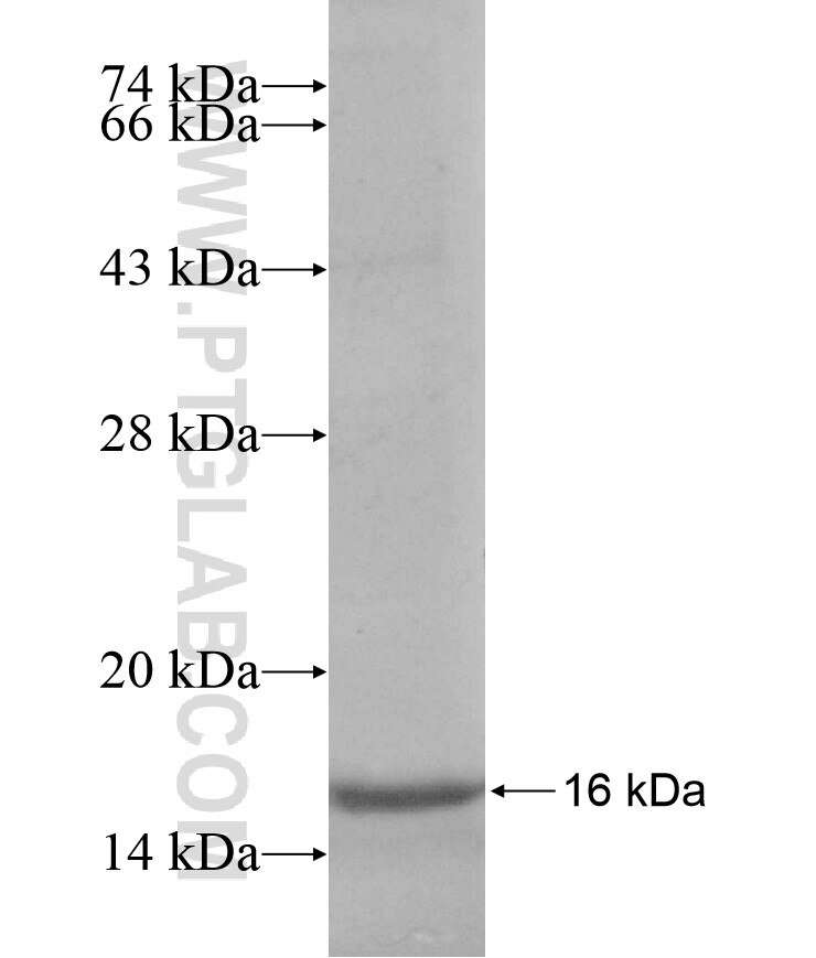 RPS6KA6 fusion protein Ag17382 SDS-PAGE