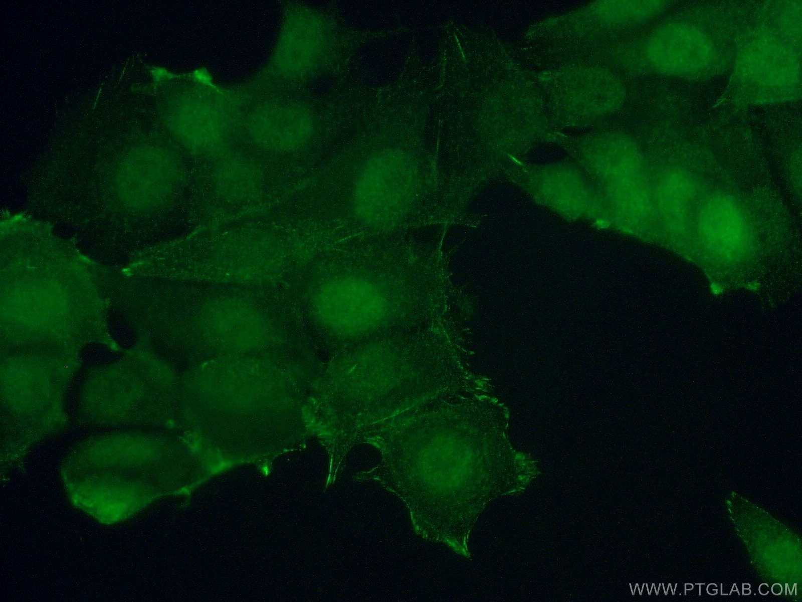 Immunofluorescence (IF) / fluorescent staining of MCF-7 cells using S6K2 Polyclonal antibody (15268-1-AP)