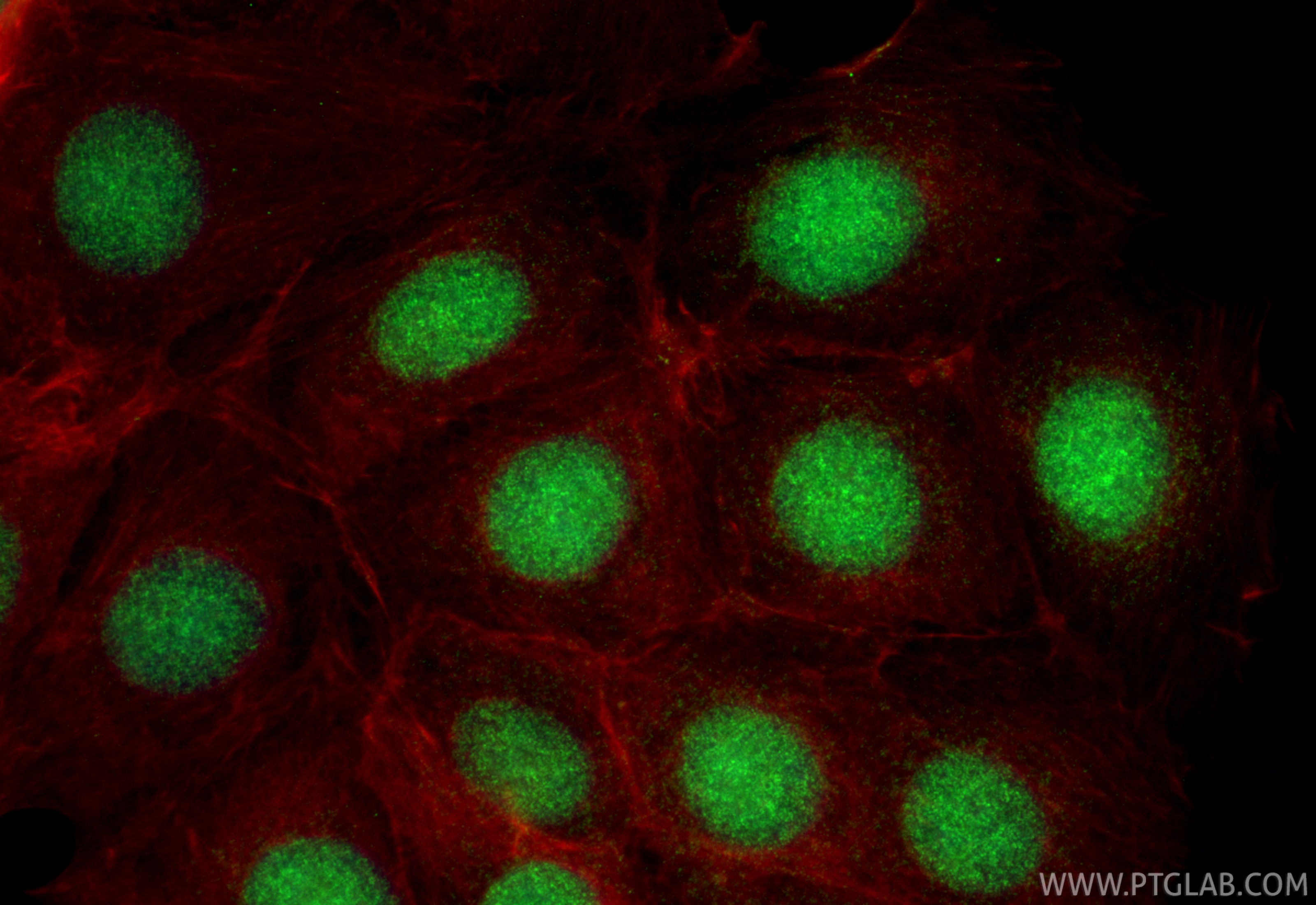 Immunofluorescence (IF) / fluorescent staining of MCF-7 cells using RPS6KB2 Polyclonal antibody (15268-1-AP)