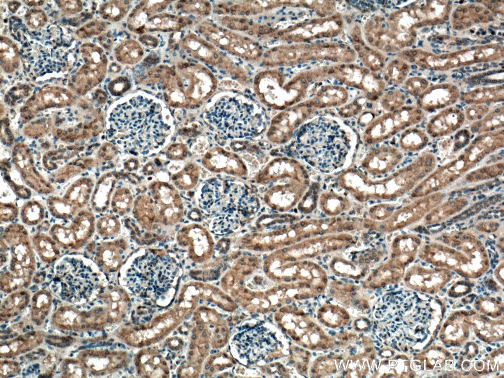 Immunohistochemistry (IHC) staining of human kidney tissue using S6K2 Polyclonal antibody (15268-1-AP)
