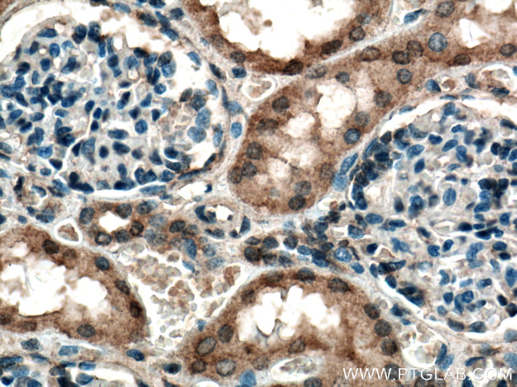 Immunohistochemistry (IHC) staining of human kidney tissue using S6K2 Polyclonal antibody (15268-1-AP)