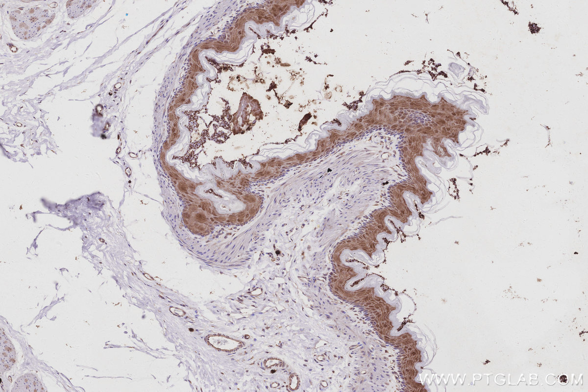 Immunohistochemistry (IHC) staining of rat stomach tissue using RPS6KB2 Polyclonal antibody (15268-1-AP)