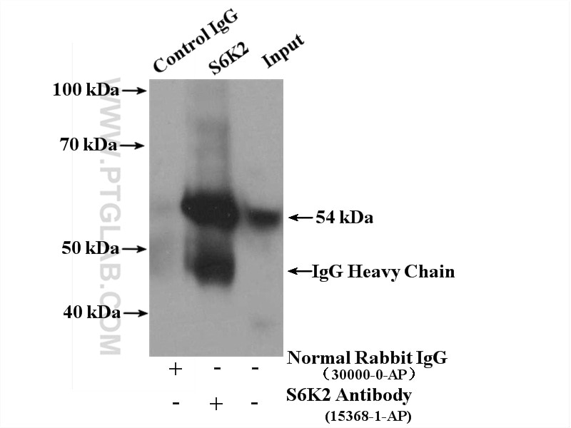 Immunoprecipitation (IP) experiment of MCF-7 cells using S6K2 Polyclonal antibody (15268-1-AP)