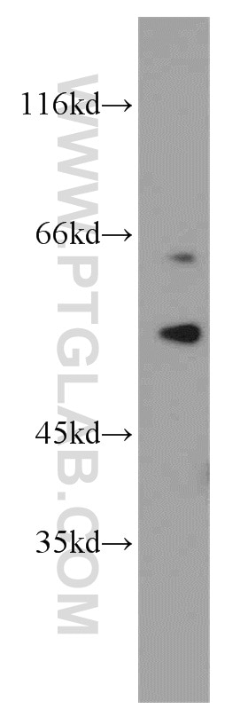 Western Blot (WB) analysis of MCF-7 cells using S6K2 Polyclonal antibody (15268-1-AP)