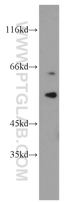 WB analysis of MCF-7 using 15268-1-AP