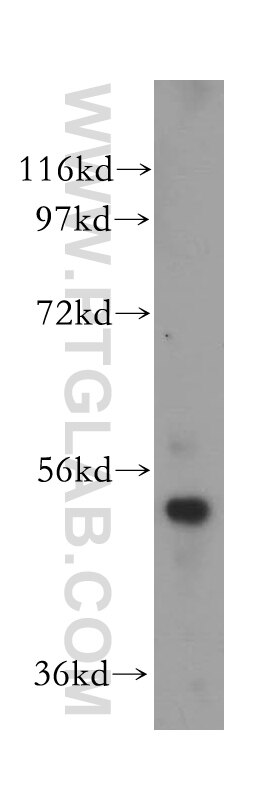 Western Blot (WB) analysis of MCF-7 cells using S6K2 Polyclonal antibody (15268-1-AP)