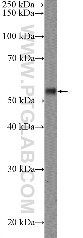 Western Blot (WB) analysis of MCF-7 cells using RPS6KB2 Polyclonal antibody (26194-1-AP)