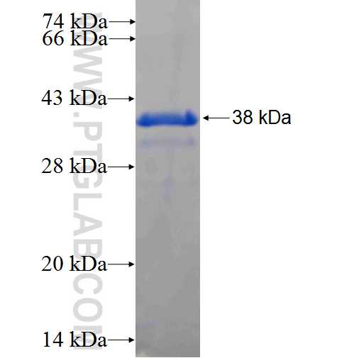 RPS6KB2 fusion protein Ag23800 SDS-PAGE