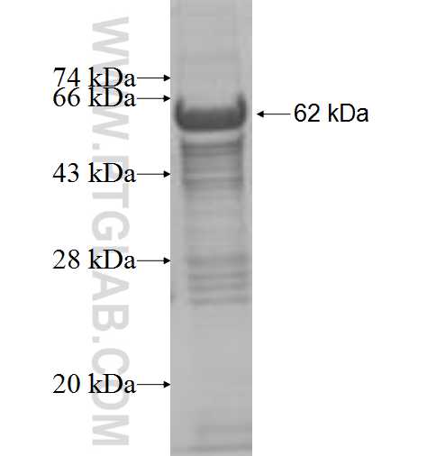 RPS6KB2 fusion protein Ag7371 SDS-PAGE